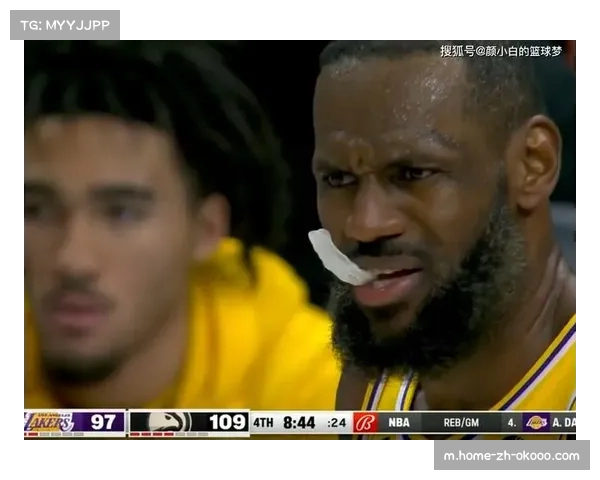 哈姆挑战与暂停管理灾难 詹姆斯多次要求遭无视